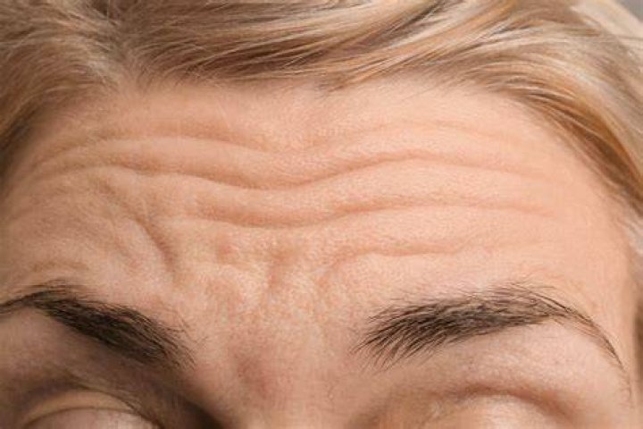 10 Forehead: Unlocking the Secrets Behind Your Face's Most Prominent Feature
